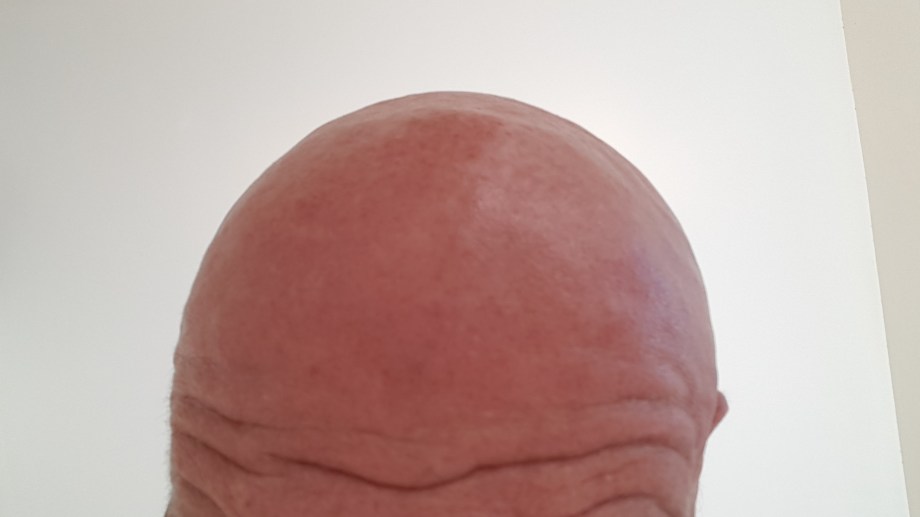 02 Mahatma Gandhi cráneo rapado